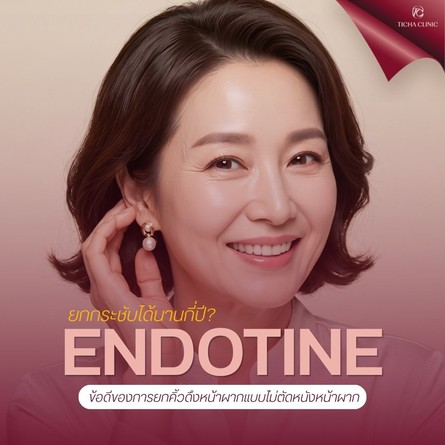 60.1 TC _ ยกกระชับด้วย Endotine อยู่ได้นานกี่ปี_ สรุปข้อดีของการยกคิ้วดึงหน้าผากแบบไม่ตัดหนังหน้าผาก
