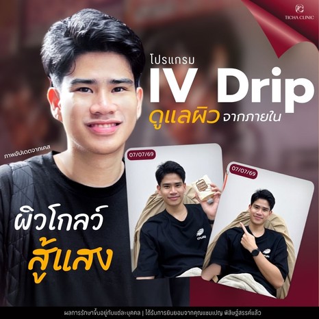 48.4 TC _ ดริปผิวขาวบ่อย ๆ มีผลเสียต่อไตไหม_ ความจริงที่สายบิวตี้ต้องรู้ก่อนเลือกสูตรดริปผิว