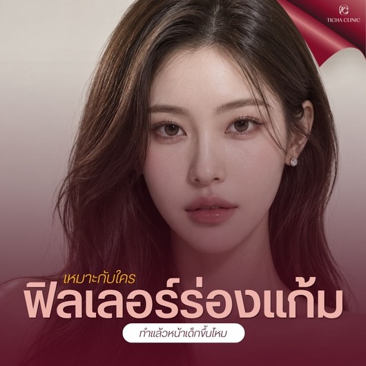 33.1 TC _ ฟิลเลอร์ร่องแก้ม เหมาะกับใคร ทำแล้วหน้าเด็กขึ้นไหม