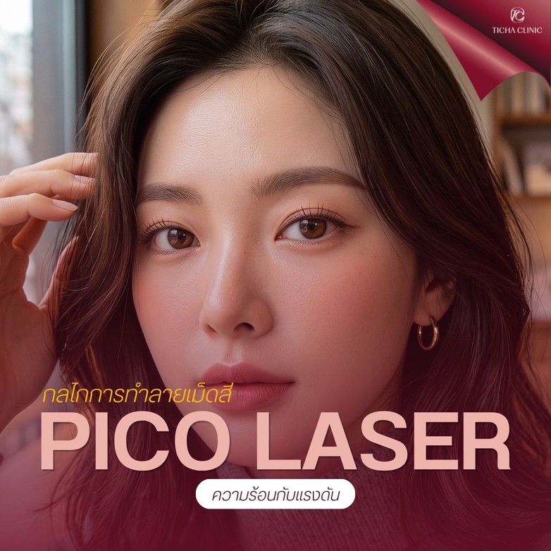 58.2 TC _ เทียบกันชัด ๆ_ Pico Laser vs เลเซอร์รุ่นเก่า Q-Switched ต่างกันอย่างไร ทำไม Pico ถึงเห็นผลไวกว่า_