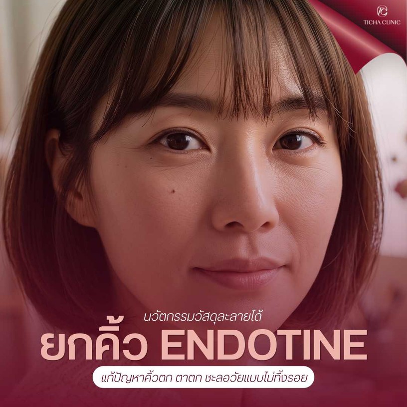 10.1 TC _ Endotine (ยกคิ้วยกหน้าผาก) นวัตกรรมวัสดุละลายได้