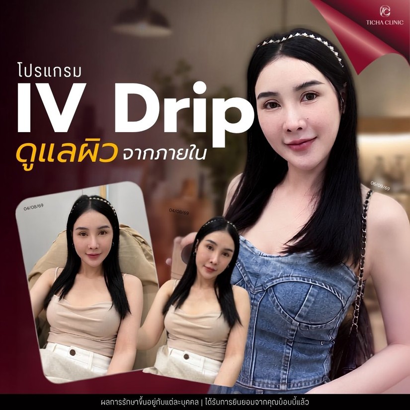 48.3 TC _ ดริปผิวขาวบ่อย ๆ มีผลเสียต่อไตไหม_ ความจริงที่สายบิวตี้ต้องรู้ก่อนเลือกสูตรดริปผิว