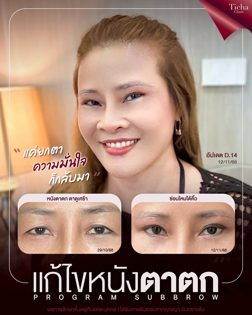 LINE_ALBUM_ซับบราว-Subbrow TC_261014_1