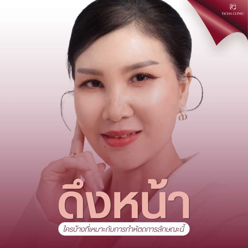 11.3 TC _ รวมรีวิวคนไข้ดึงหน้า Deep Face Lock_ เปลี่ยนจาก _ป้า_ เป็น _พี่สาว_ ย้อนวัยได้จริงกี่ปี_