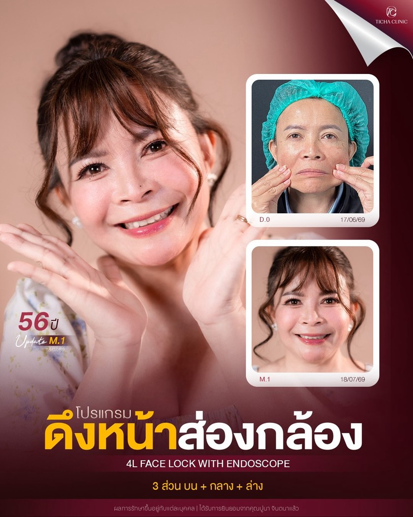 LINE_ALBUM_ดึงหน้า Face Lock TC_261012_2