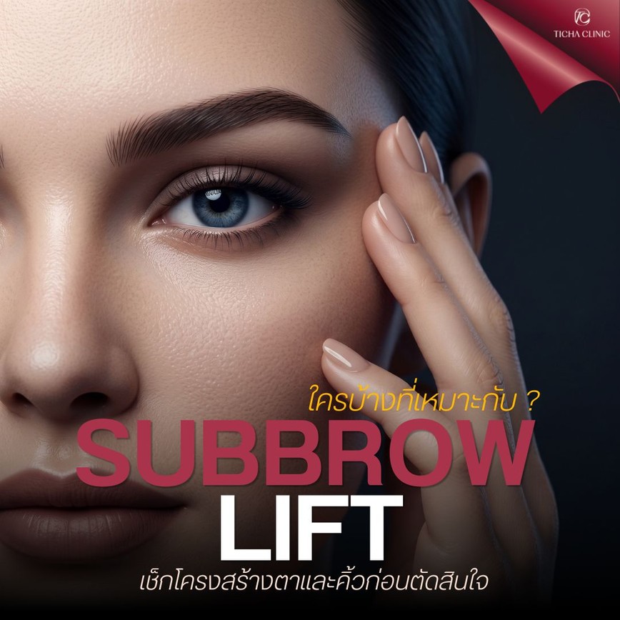 16.1 TC _ ใครบ้างที่เหมาะกับ Subbrow Lift_ เช็กโครงสร้างตาและคิ้วก่อนตัดสินใจ