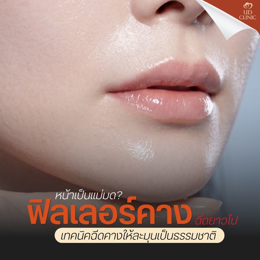 38.1 UD _ ฉีดฟิลเลอร์คางยาวไป หน้าเป็นแม่มด_ เทคนิคฉีดคางให้ละมุนเป็นธรรมชาติ