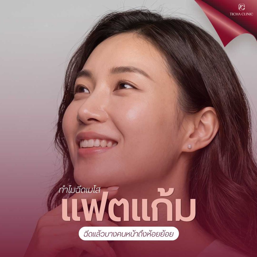 56.2 TC _ ฉีดเมโสแฟตแก้มแล้วหน้าห้อยย้อย_ เปิดเทคนิคฉีดแฟตควบคู่กับการยกกระชับไม่ให้ผิวหย่อน