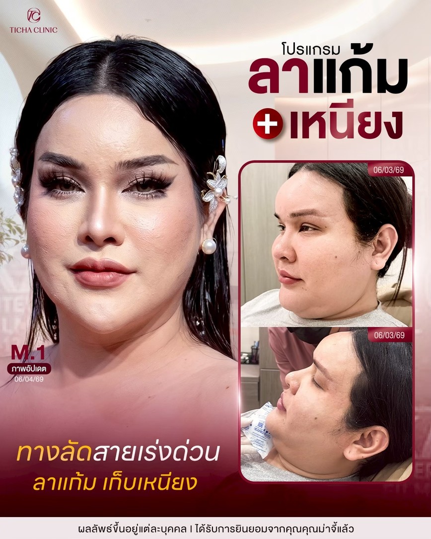 LINE_ALBUM_Skin Ticha - 3_260808_3