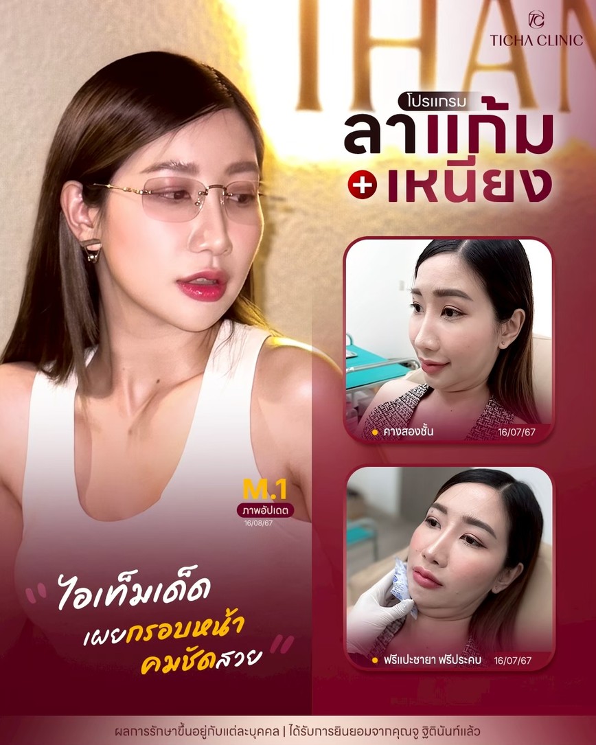 LINE_ALBUM_Skin Ticha - 3_260819_3