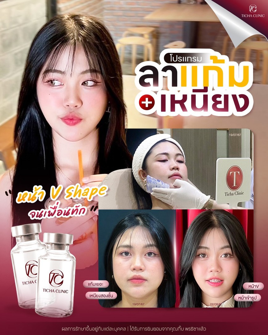 LINE_ALBUM_Skin Ticha - 3_260819_4