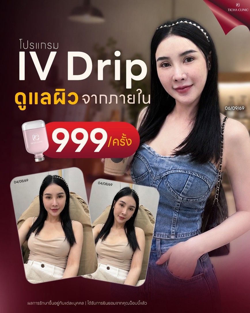 LINE_ALBUM_Skin Ticha - 3_260901_2
