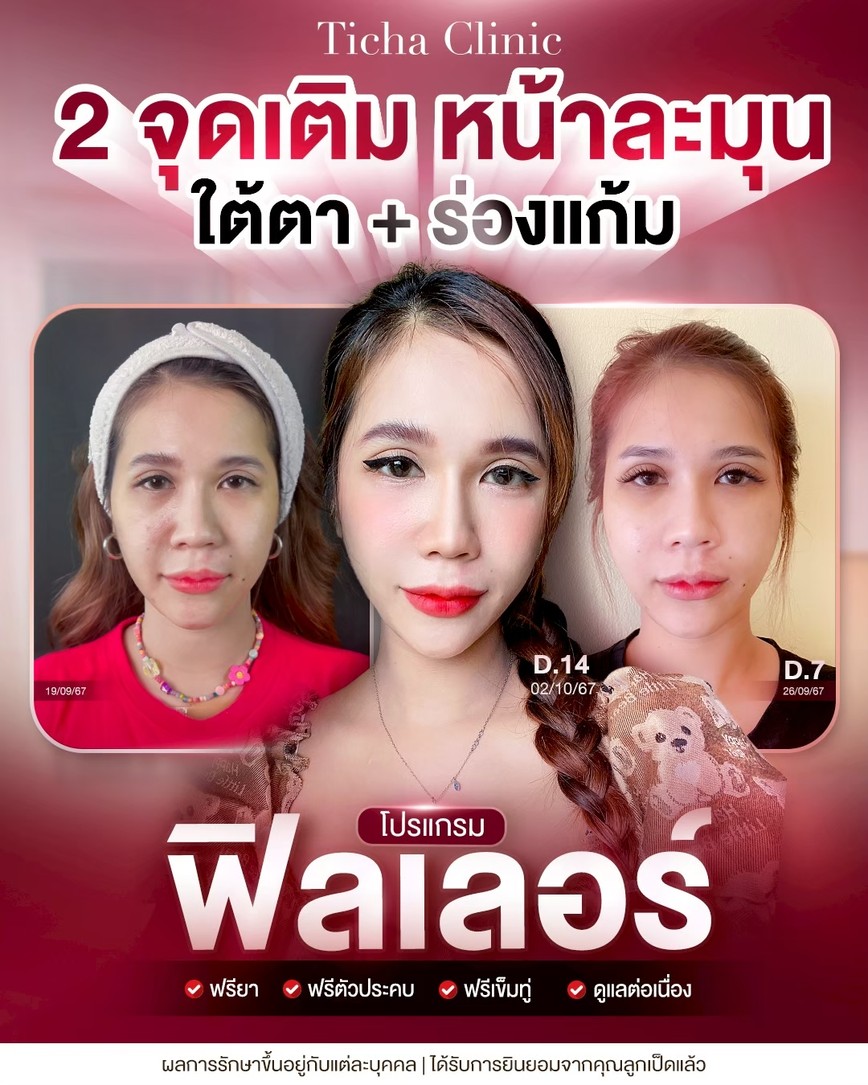 LINE_ALBUM_Skin Ticha - 3_260904_2