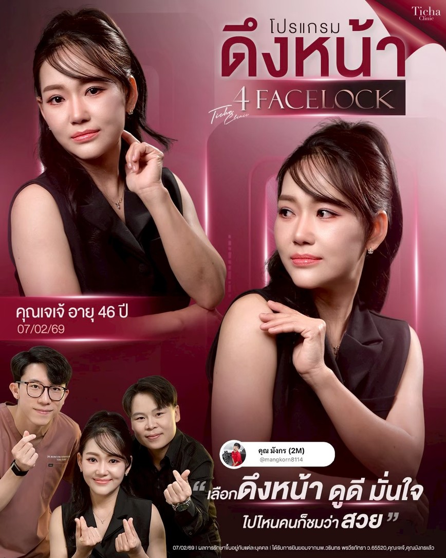 LINE_ALBUM_ดึงหน้า Face Lock TC_260812_3
