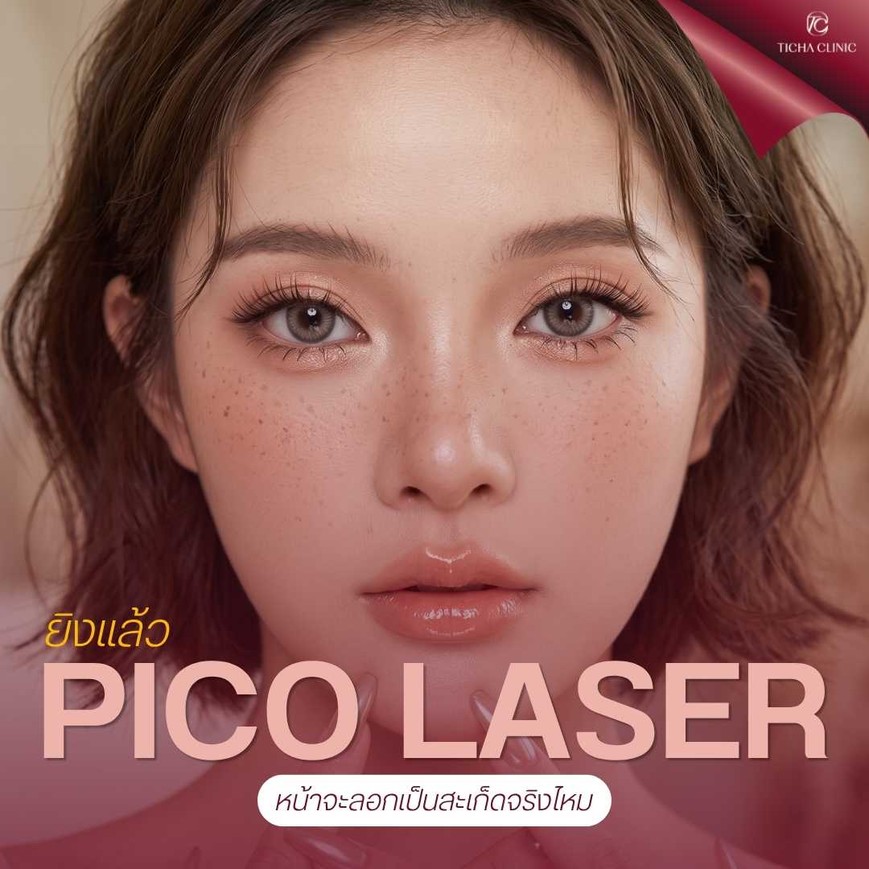 40.2 TC _ Pico Laser รักษารอยแผลเป็นจากสิว ยิงแล้วหน้าจะลอกเป็นสะเก็ดไหม_ วิธีดูแลผิวหลังทำ Pico