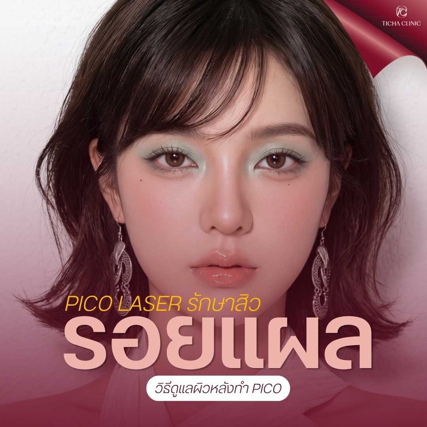 40.1 TC _ Pico Laser รักษารอยแผลเป็นจากสิว ยิงแล้วหน้าจะลอกเป็นสะเก็ดไหม_ วิธีดูแลผิวหลังทำ Pico
