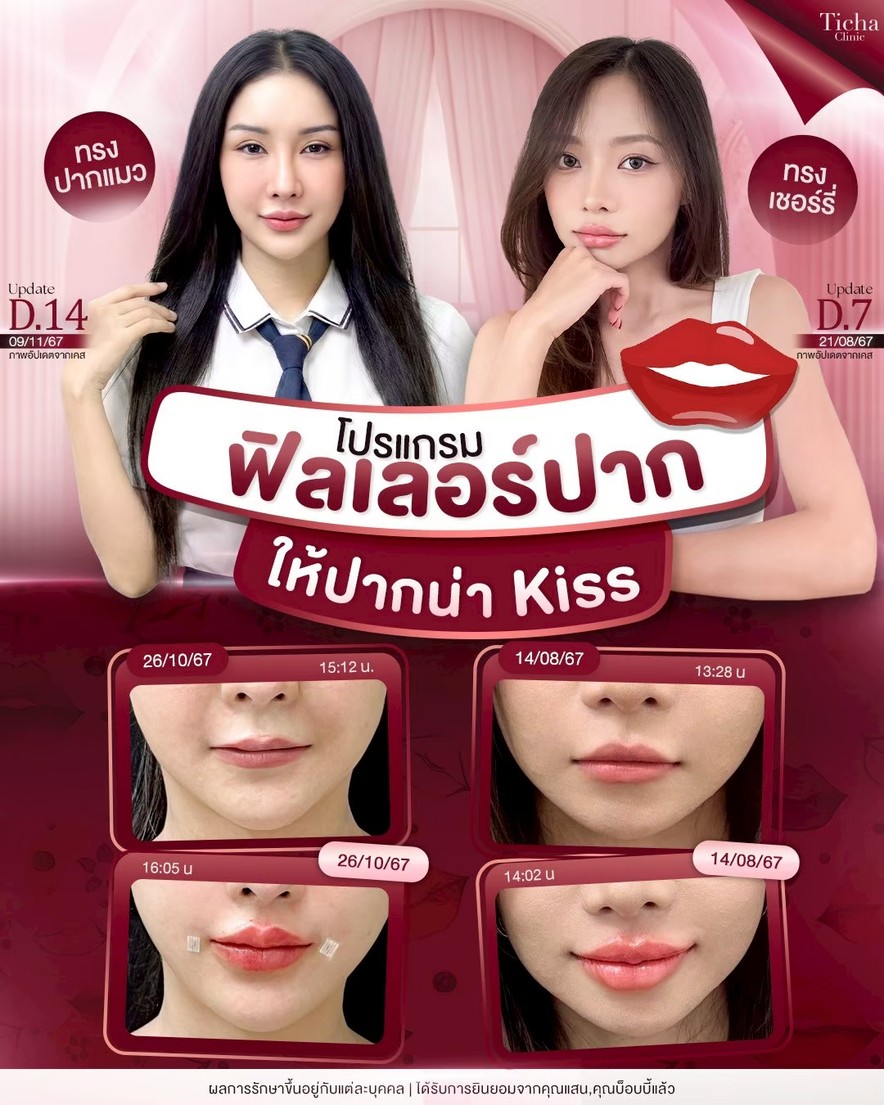LINE_ALBUM_Skin Ticha - 3_260827_1