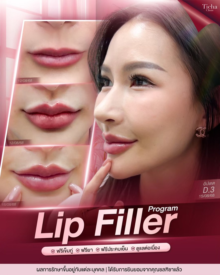 LINE_ALBUM_Skin Ticha - 3_260827_2