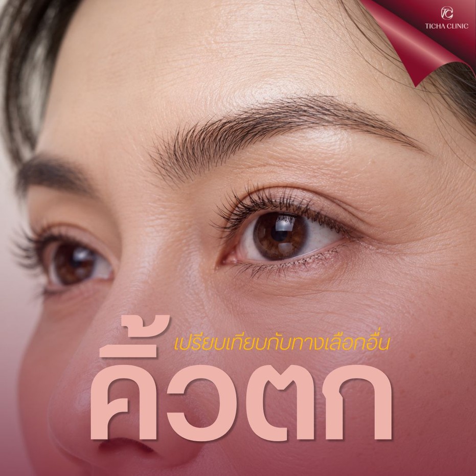 9.4 TC _ ยกคิ้ว Endotine แก้ปัญหาอะไรได้บ้าง_ คิ้วตก หน้าผากย่น หางตาตก จบได้ในการผ่าตัดเดียวจริงไหม
