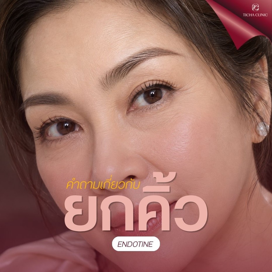 9.5 TC _ ยกคิ้ว Endotine แก้ปัญหาอะไรได้บ้าง_ คิ้วตก หน้าผากย่น หางตาตก จบได้ในการผ่าตัดเดียวจริงไหม