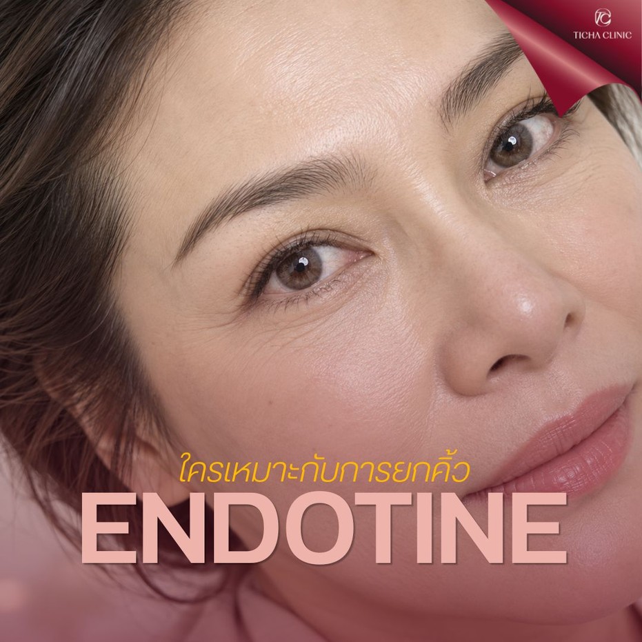 9.3 TC _ ยกคิ้ว Endotine แก้ปัญหาอะไรได้บ้าง_ คิ้วตก หน้าผากย่น หางตาตก จบได้ในการผ่าตัดเดียวจริงไหม