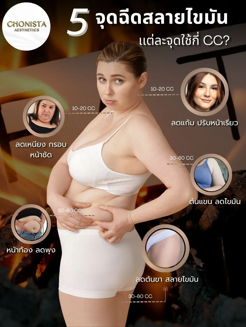 เมโสแฟต5จุดสลายไขมัน