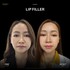 LIP01