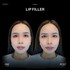 LIP05