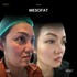 MESOFAT03