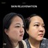 SKINREJUVENATION02