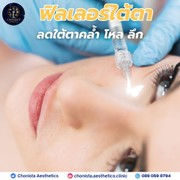 ฟิลเลอร์ใต่ตาคืออะไร1038765878748