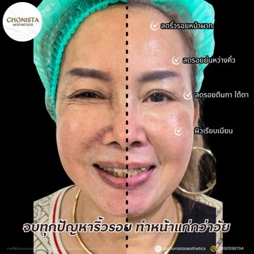 FBโปรแกรมโบเจนใหม่2
