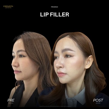 LIP02