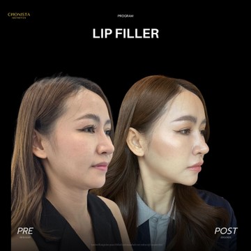 LIP03
