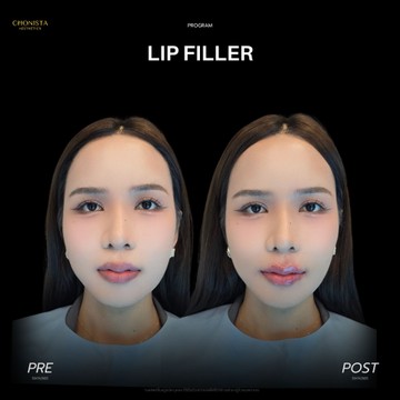 LIP05