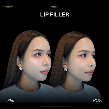 LIP06