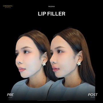 LIP08