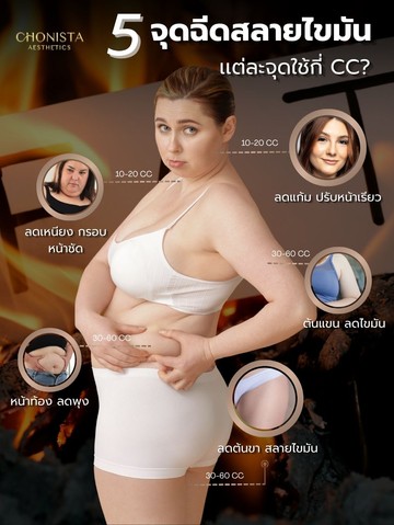 MESOFATแต่ละจุด