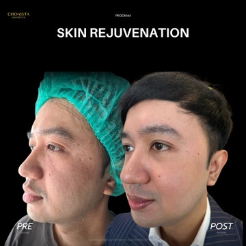 SKINREJUVENATION01