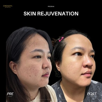 SKINREJUVENATION02