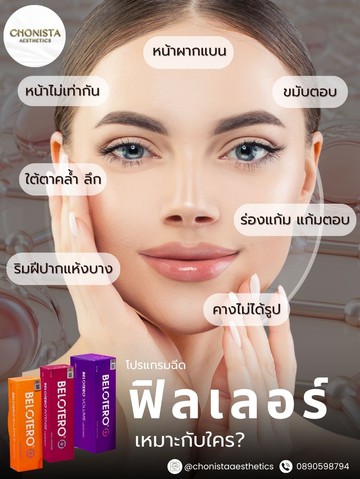 ฟิลเลอร์11
