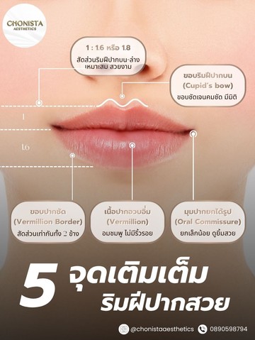 ฟิลเลอร์15