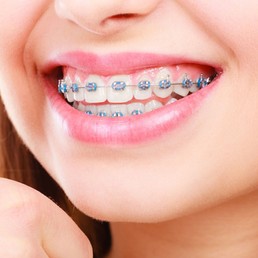 vsmiledentalclinic-services1