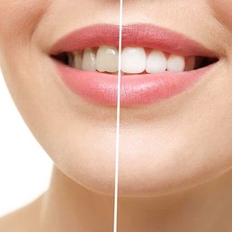 vsmiledentalclinic-services2