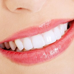 vsmiledentalclinic-services3