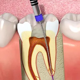 vsmiledentalclinic-services5