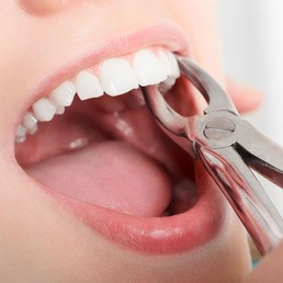 vsmiledentalclinic-services8