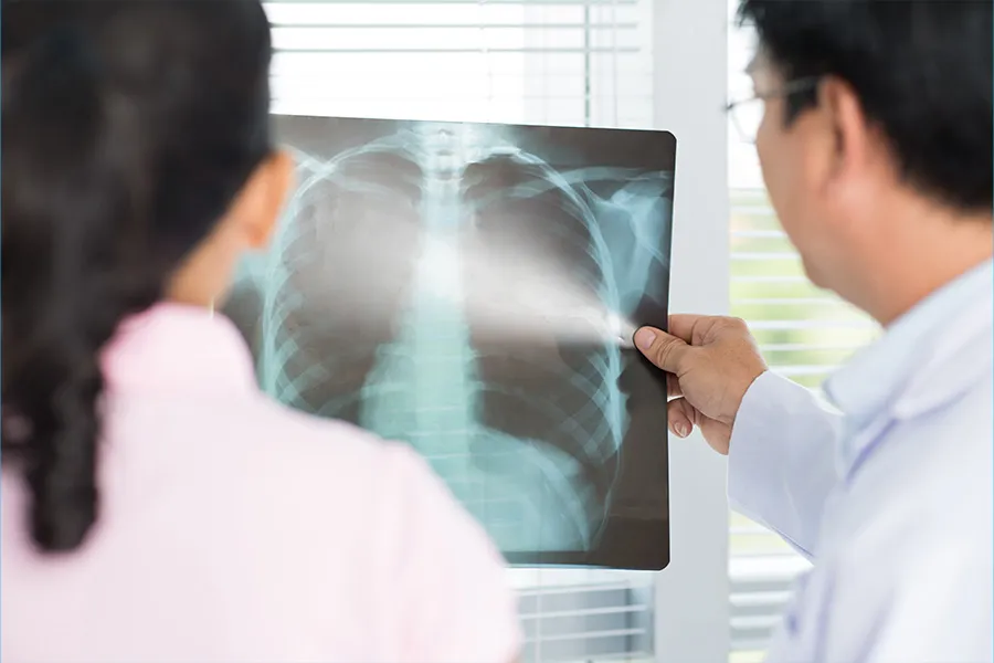 4-การเอกซเรย์ปอด-(Chest-X-ray)