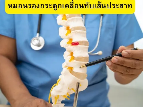 หมอนรองกระดูกทับเส้นประสาท