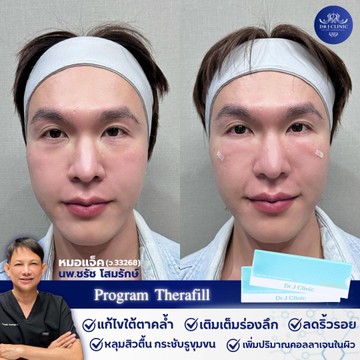 รีวิว(3)